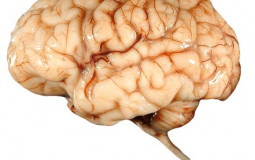 Brain