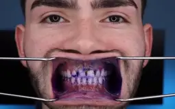 What