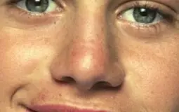 Ethereal face pit