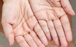 Top Finger I