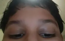 Adolscent