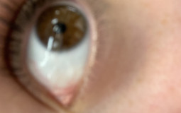 Marleys poopy bum