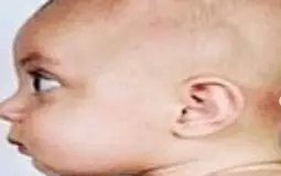 T-Com